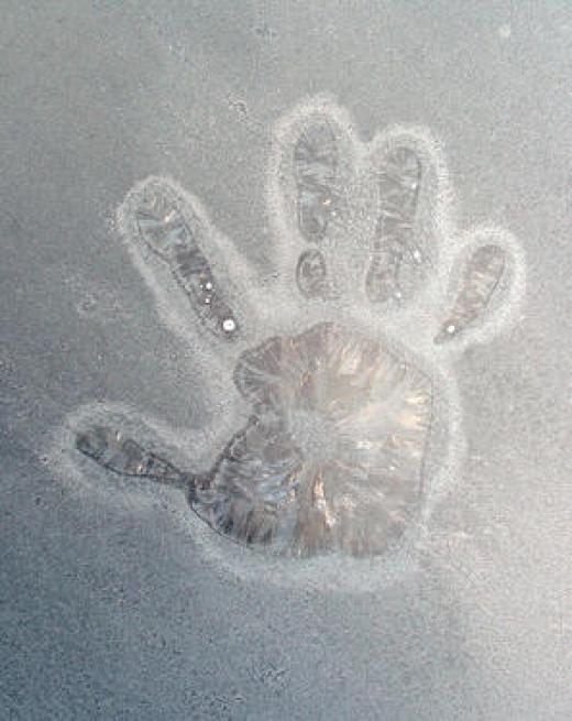 https://perspectives.einstein.edu/5-myths-about-frostbite